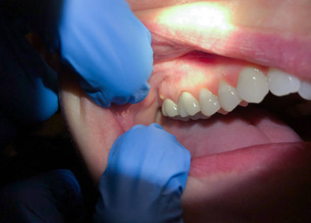 Best Same-Day Emergency Dental Services in San Ramon, CA